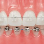 ortodontie